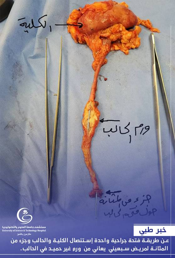 إجراء عملية نوعية وكبرى لمريض سبعيني 